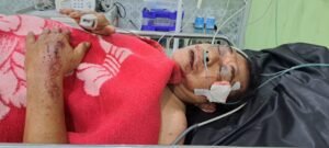 Malang Nasib Marjo, Kecelakaan di Jalan Provinsi di Lubuk Basung, Agam